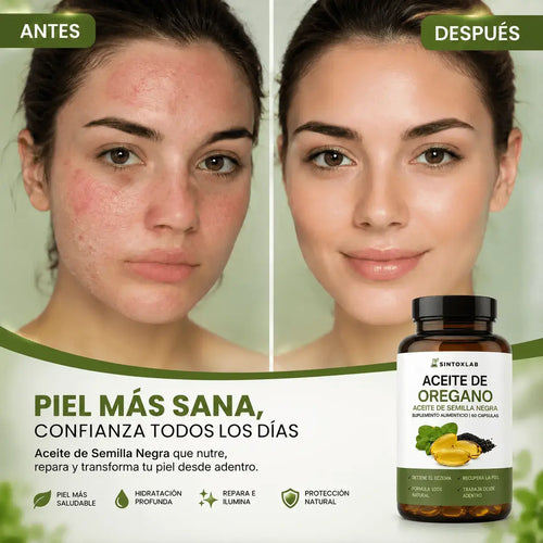 ✨ Chau brotes y picazón. Recuperá una piel sana y suave.